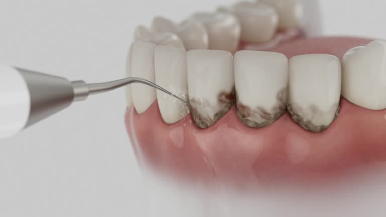 Trusted Teeth Cleaning And Checkup service in Windsor, MO - Dentist Open Now